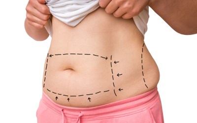 6 Tips To Find The Best Body Contouring Near Me