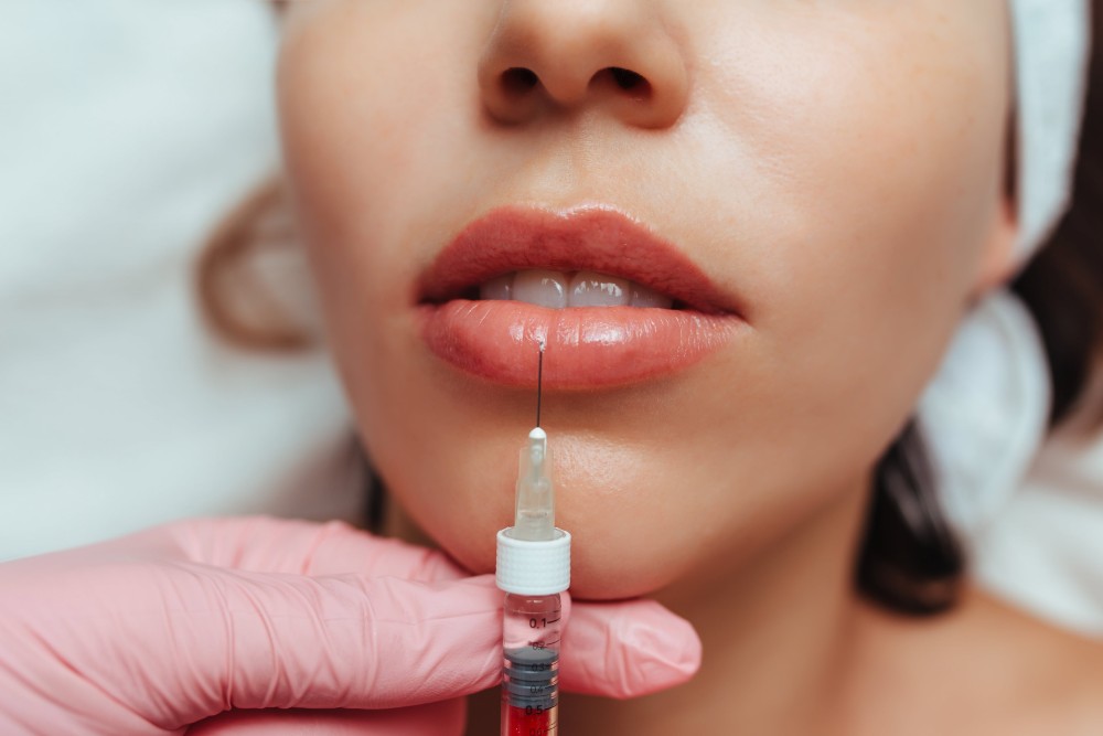 lip filler fort collins