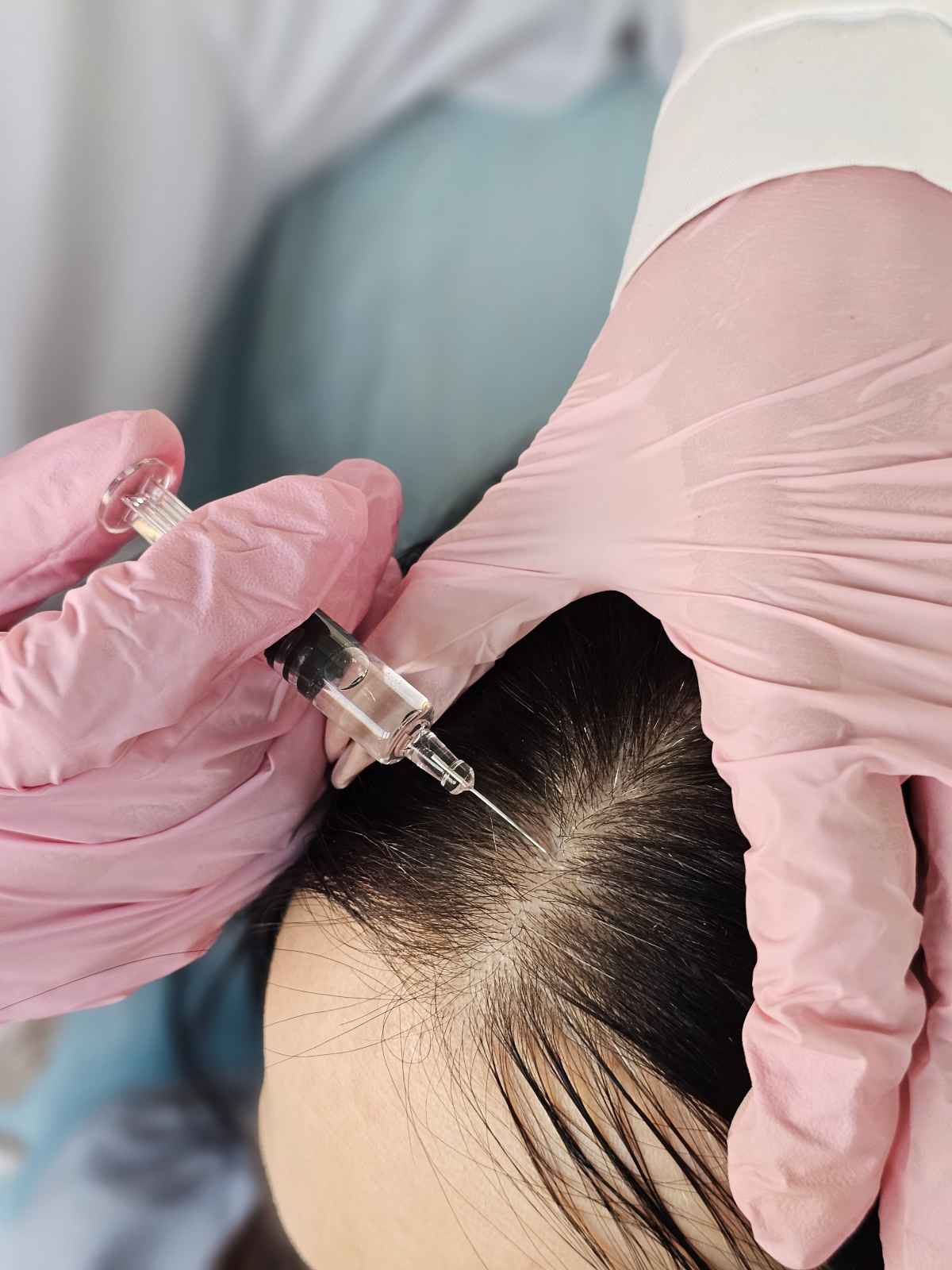 for collins hair restoration