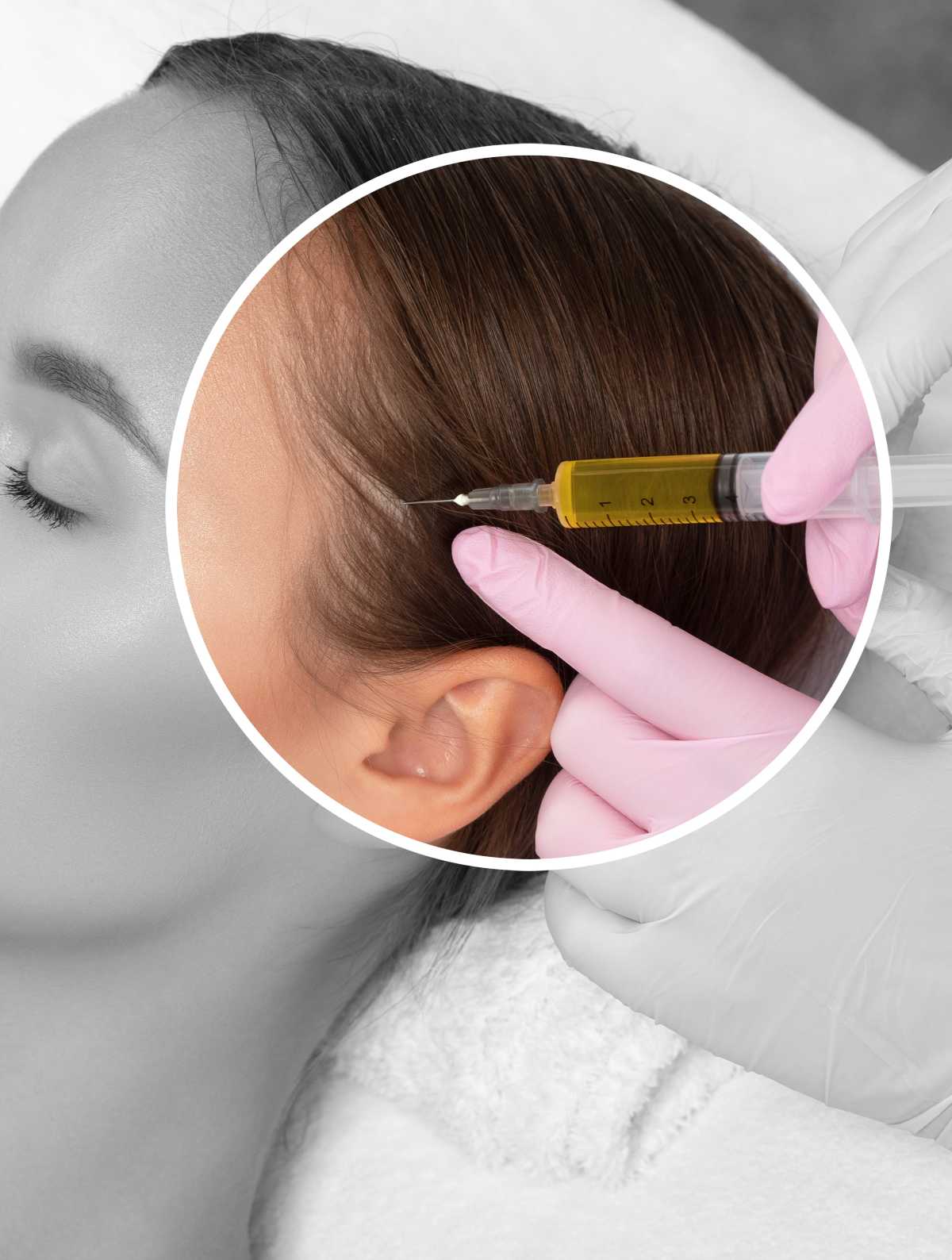 windsor-colorado-hair-restoration