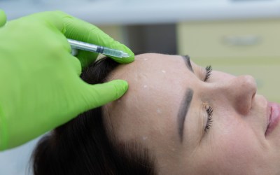 6 Botox Side Effects: Whats Normal and What Isn’t in Colorado?