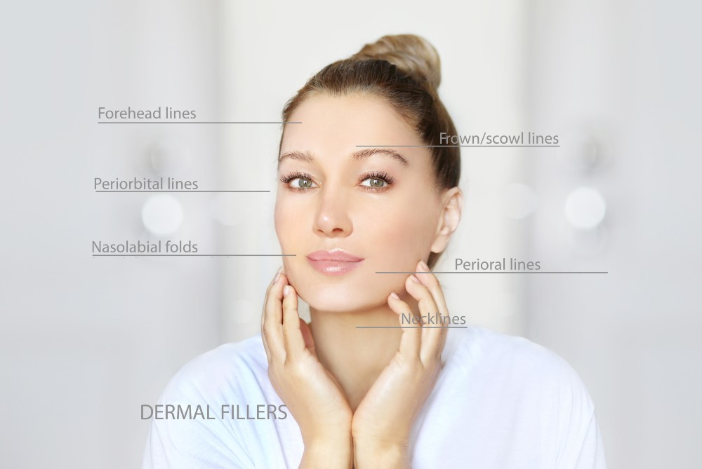 what are dermal fillers