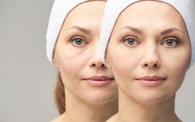 Anti-Aging Clinic in Greeley | What Actually Works After 40