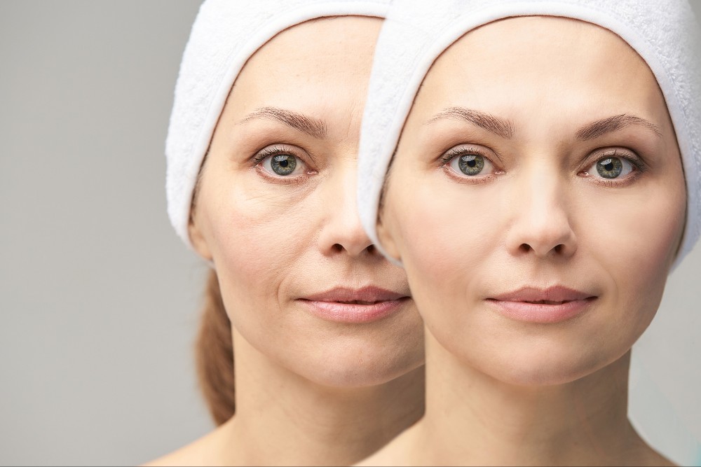 Anti-Aging Clinic in Greeley | What Actually Works After 40