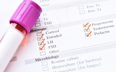 Hormone Testing in Northern Colorado | Understanding Your Panel Results